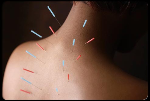 acupuncture espalda cervical